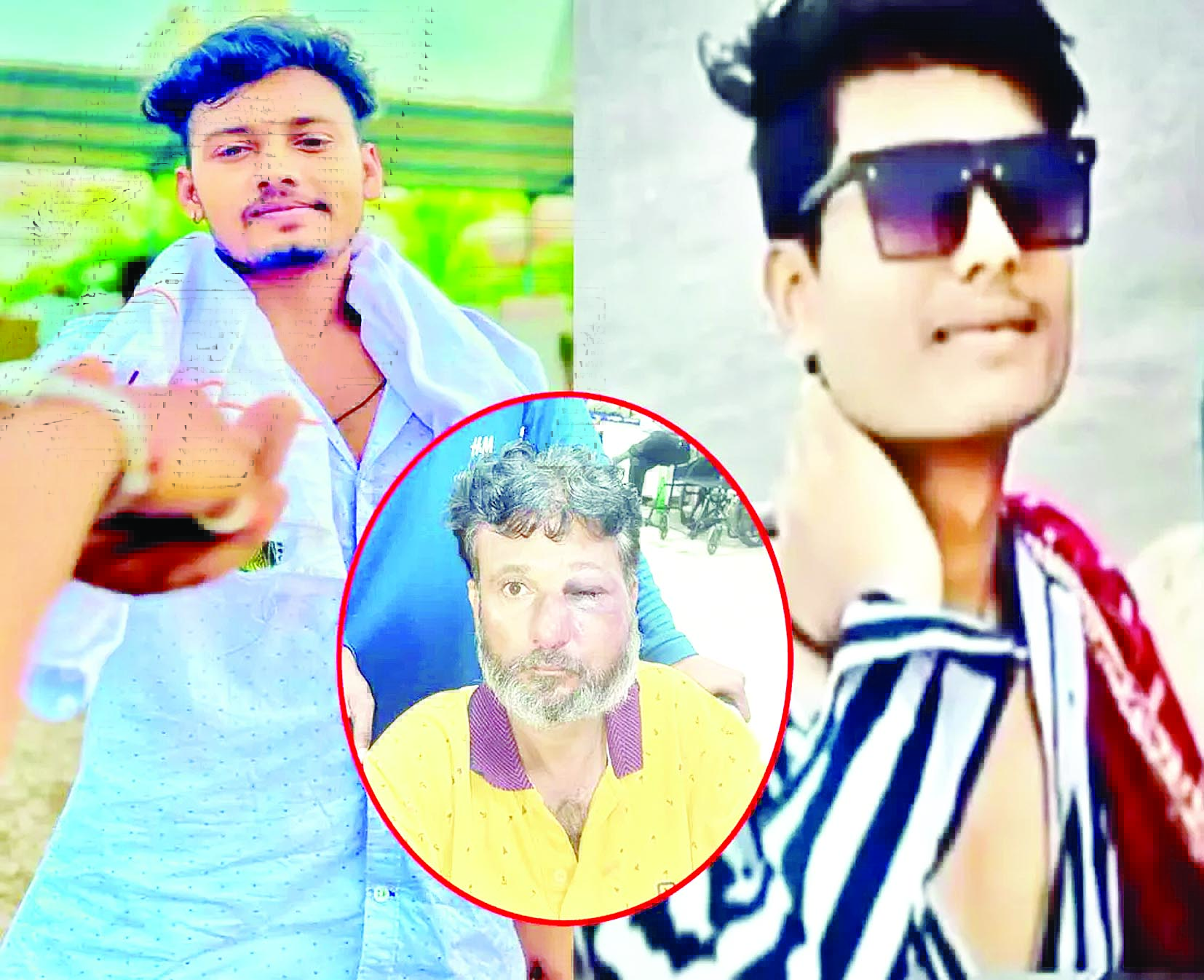 ट्रक चालक ने ऑटो चालक पर किया जानलेवा हमला, FIR दर्ज 