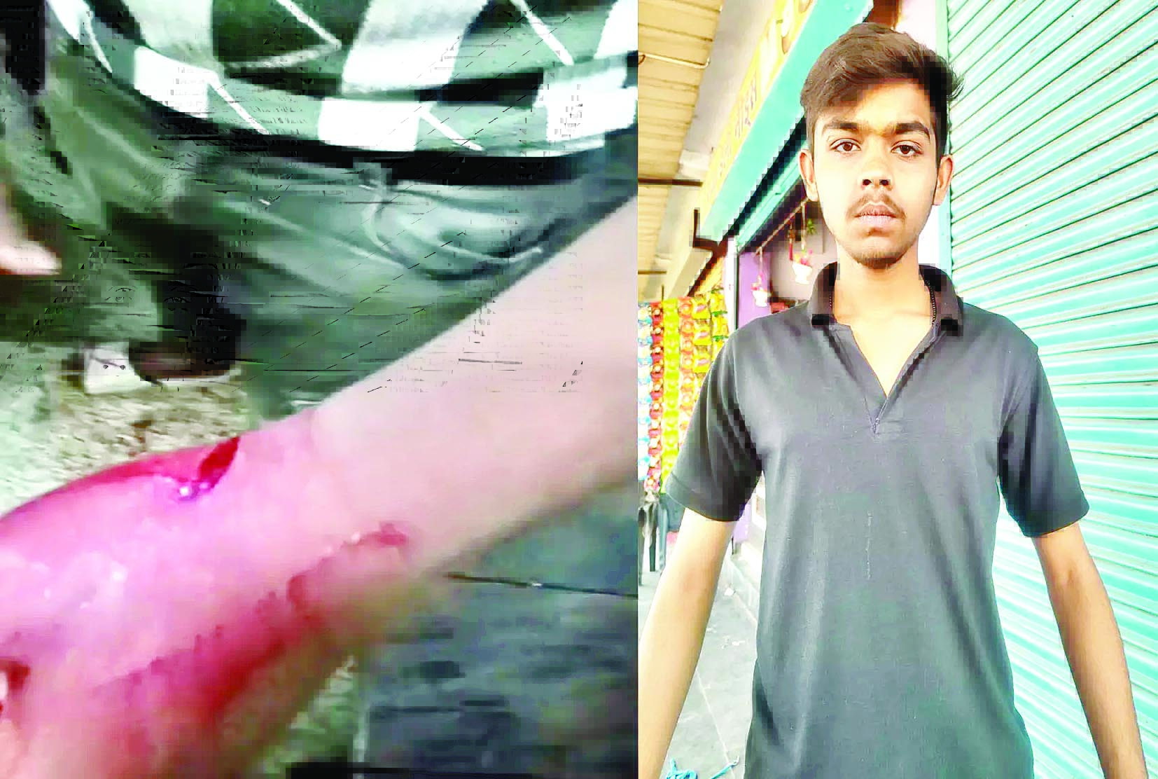 रायपुर में चाकूबाजी: नशे में गुपचुप वाले से पैसे मांगकर किया प्राणघातक हमला 