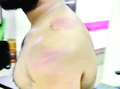 108 एम्बुलेंस का चालक नौकरी से बर्खास्त, मारपीट का आरोप 