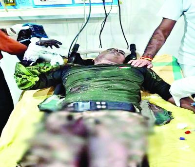 IED बम की चपेट में आने से जवान घायल 