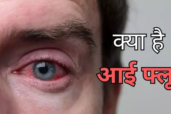 Eye Flu Alert: เคฎเคพเคจเคธเฅเคจ เคฎเฅเค เคฌเคขเคผเคพ Eye Flu เคเคพ เคเคคเคฐเคพ, เคเคพเคจเคฟเค เคเคธเคเฅ เคฒเคเฅเคทเคฃ เคเคฐ เคฌเคเคพเคต เคเฅ เคเคธเคพเคจ เคเคชเคพเคฏ